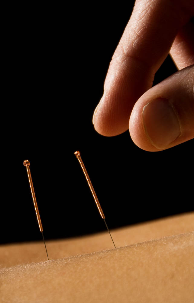 Acupuncture education /Acupunctuur opleiding: Shenzhou Open University of TCM Acupuncture education /Acupunctuur opleiding: Shenzhou Open University of TCM
