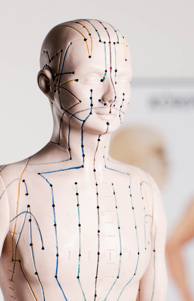 acupuncture model