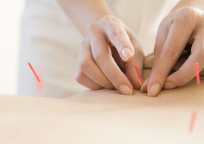 Acupuncture in Pain Management and the Underlying Ide