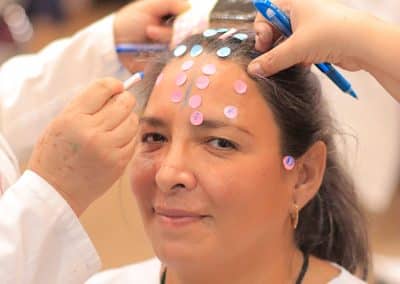 YNSA – Yamamoto New Scalp Acupuncture – FULLY BOOKED